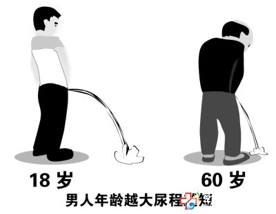 前列腺增生如何治疗好？—石狮男科医院