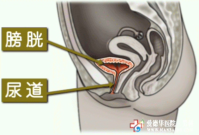 对于膀胱炎该如何治疗呢_九江医大医院