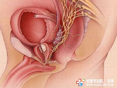 男性前列腺增生怎么办-石狮京都医院