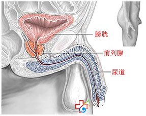 男性尿道滴白是急性前列腺炎吗_石狮京都医院