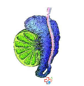 怎样的检查可以确诊慢性附睾炎？