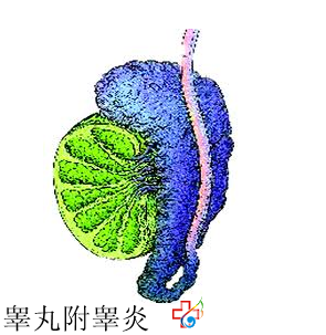 睾丸附睾炎一般都有哪些危害呢？九江医大医院