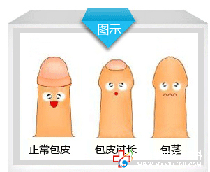 包皮过长对男性会怎样